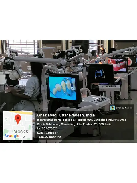 Magnification in dentistry, photo 4