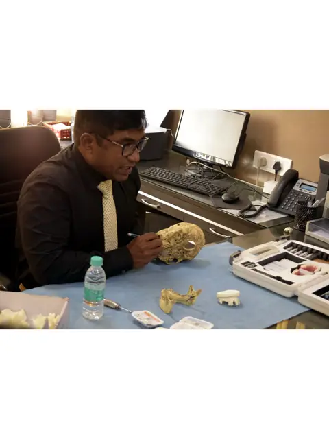 Introduction to Damon System — A Passive Self Ligation Bracket System, photo 3