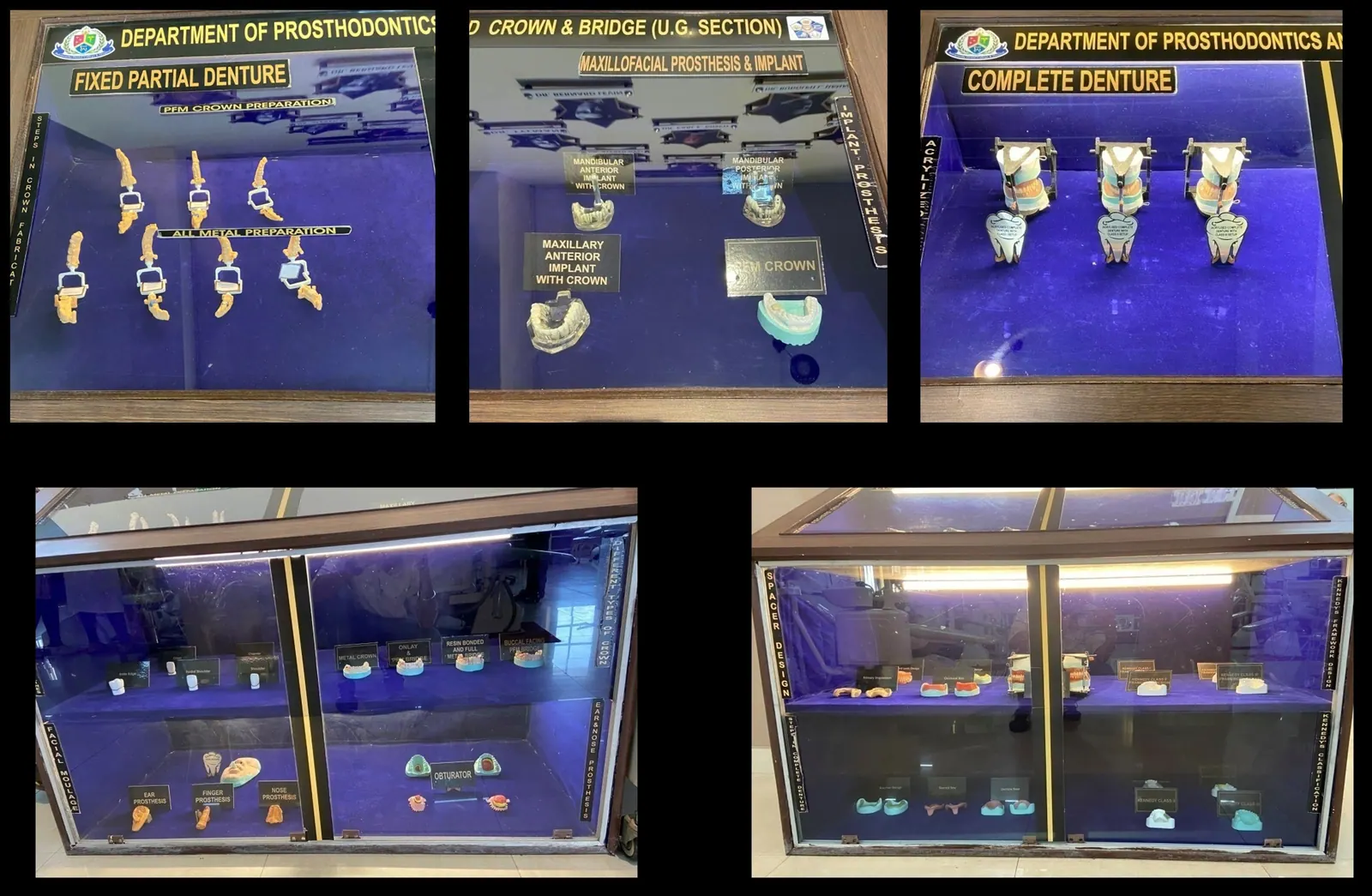 Departmental showcase, Undergraduate section (BDS), Department of Prosthodontics and Crown & Bridge, Inderprastha Dental College